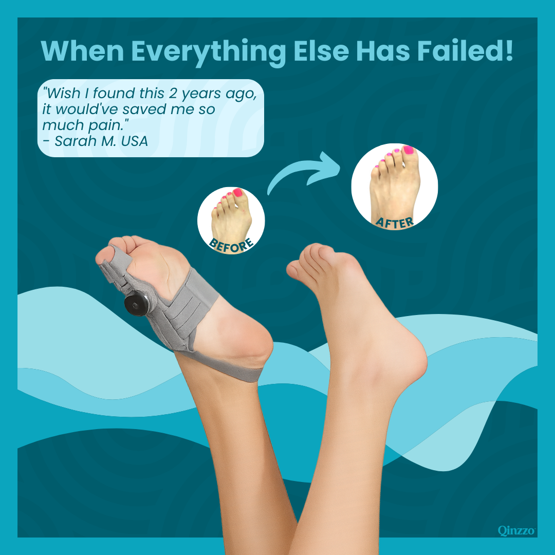 BunionEase™ Non-Surgical Fix